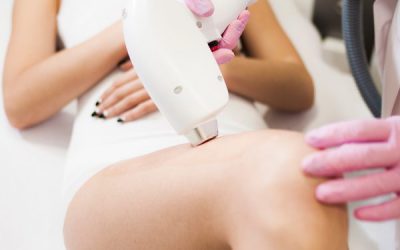 Veelgestelde vragen over de Brazilian Wax